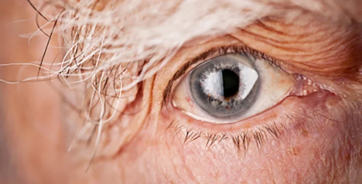 degeneração macular