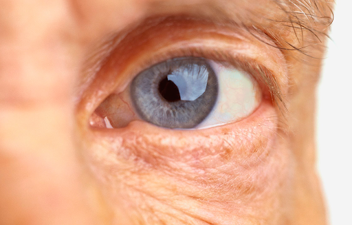 buraco macular