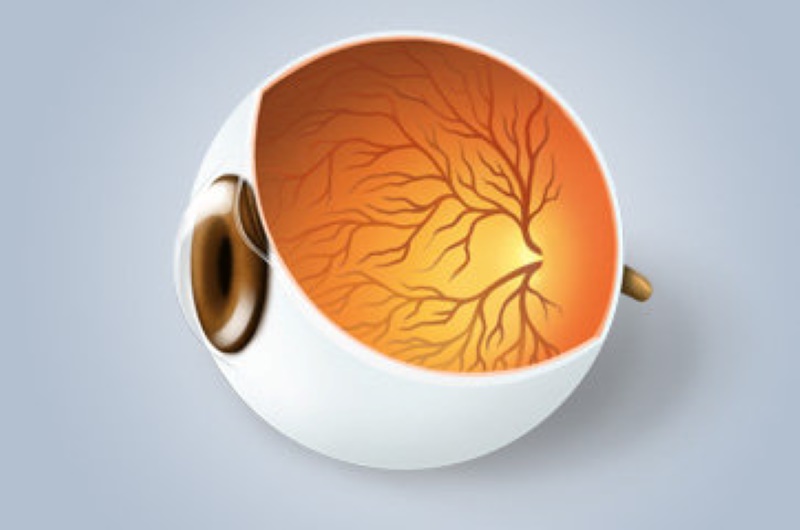 Oclusões Vasculares Retinianas