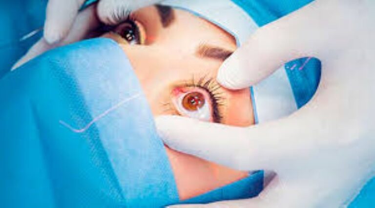 Cirurgia para Buraco Macular